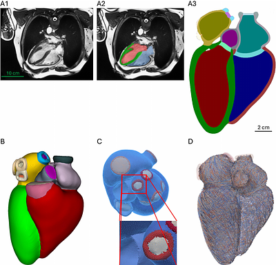 A Cohort-Based Global Sensitivity Benchmark of MRI-Derived Whole-Heart Electromechanical Models in Healthy Hearts