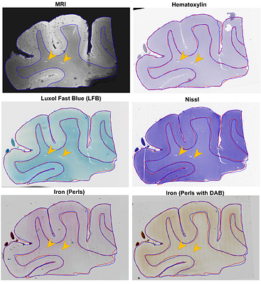 Precise MRI-Histology Coregistration of Paraffin-Embedded Tissue with Blockface Imaging
