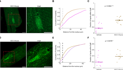 Single molecule imaging reveals extracellular signal-regulated kinases dependent signal responsive spatial regulation of translation in cardiomyocytes