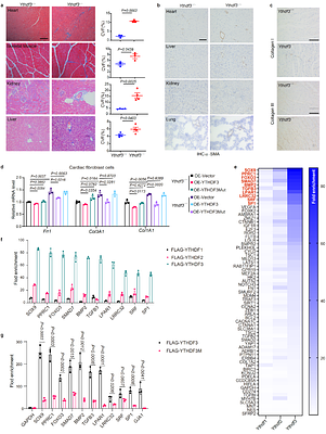 Loss of Ythdf3 causes Danon disease-like features