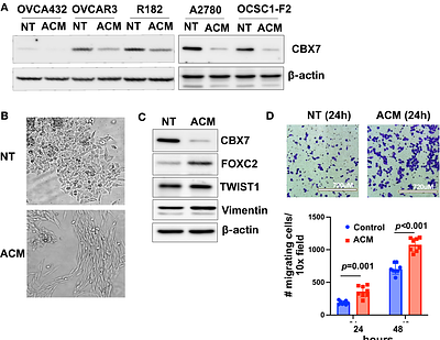 Adipose-derived exosomal miR-421 targets CBX7 and promotes metastatic potential in ovarian cancer cells