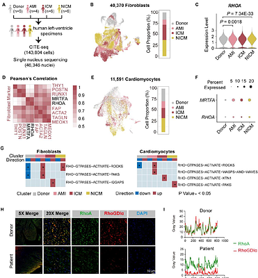Inhibiting RhoA Activation via GDP-state Stabilization to Relieve Heart Failure