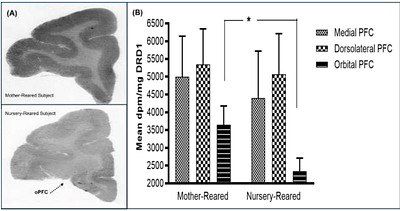 Early life stress of maternal deprivation and peer-rearing jeopardize mesoprefrontal and mesolimbic dopamine receptors in the rhesus monkey