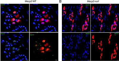 Loss of enteric BDNF TrkB signaling and VIPergic dysfunction underlie gastrointestinal dysmotility in a Mecp2-null mouse model of Rett syndrome