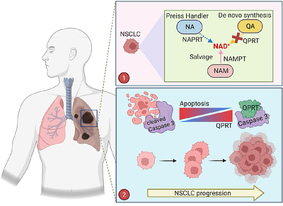 Quinolinic acid phosphoribosyl transferase moonlights as an apoptosis regulator to empower lung cancer progression
