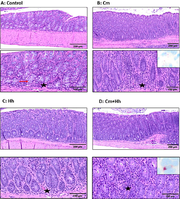 Chlamydia muridarum Infection Impacts Murine Models of Intestinal Inflammation and Cancer