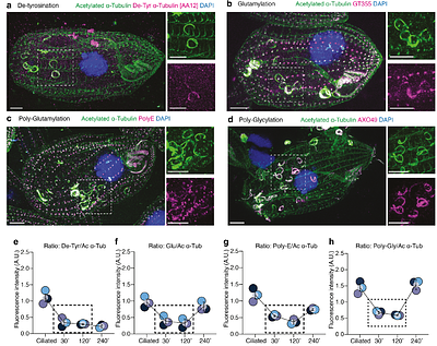 Motile ciliophagy promotes ciliary recycling under stress