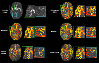 VesSynth: Tubes Are All You Need for Robust Cross-Scale Cross-Modal 3D Vessel Segmentation