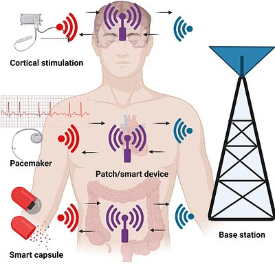Semantic-Aware Energy-Efficient Operation inSmart Capsule Endoscopy