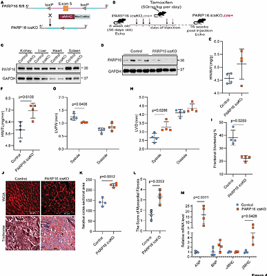 PARP16 protects against cardiac hypertrophic response by ADP-ribosylation-dependent inhibition of NFAT transcription factor