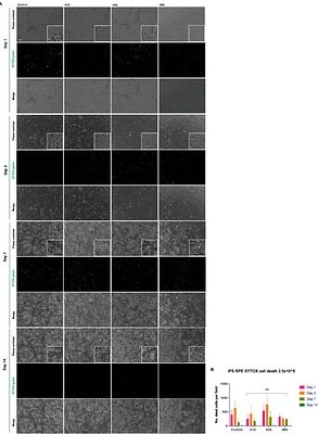 Microneedle delivery of stem cell derived retinal pigment epithelial cells
