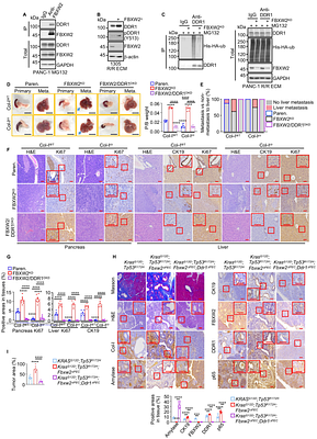 Inflammatory memory disables a DDR1 degradation checkpoint to enable pancreatic cancer growth
