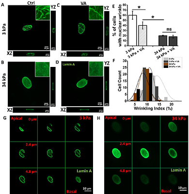 Histone acetylation alters nuclear morphology and architecture of human mesenchymal stem cells in rigidity dependent manner