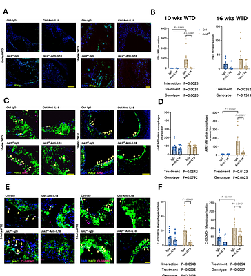 IL-18 inhibition enlarges lesions, necrotic cores and thickens fibrous caps in Jak2V617F clonal hematopoiesis-driven atherosclerosis.