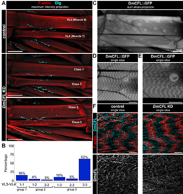 Muscle cofilin alters neuromuscular junction postsynaptic development to strengthen functional neurotransmission