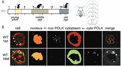 An altered cell type-specific subcellular distribution of translesion synthesis DNA polymerase kappa (PolK) in aging neurons