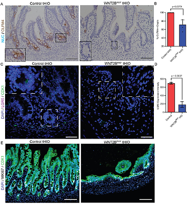 Mesenchymal WNT2B is Required for the Development and Function of the Human Intestine