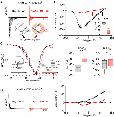 Selectivity filter mutation in NaV1.5 promotes ventricular tachycardia