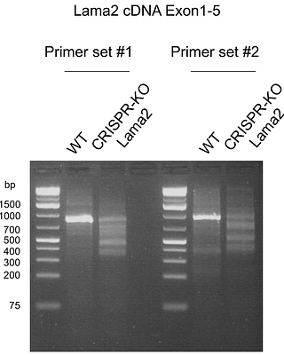 Basement Membrane Structural Integrity Dictates Trans-Tissue Deposition of Laminin in Mammals