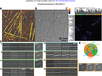 Cryo-EM image processing of amyloid filaments in RELION-5.1