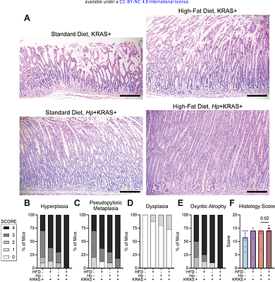 Diet-Induced Obesity Exacerbates Helicobacter pylori-Associated Precancerous Phenotypes