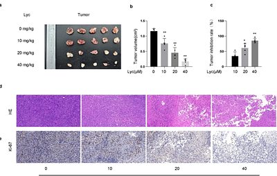 Lycopene Suppresses Lung Cancer Progression via PI3K/AKT Pathway Inhibition and Apoptosis Induction: Mechanistic and Safety Insights from Preclinical Models