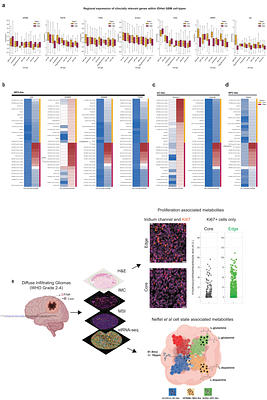 Integrated single cell spatial multi-omics landscape of WHO grades 2-4 diffuse gliomas identifies locoregional metabolomic regulators of glioma growth
