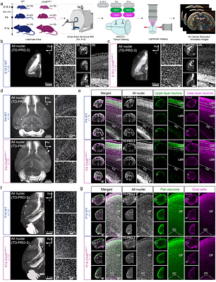 Chd8 haploinsufficiency leads to molecular layer heterotopias and age-dependent cortical expansion