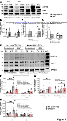 Elucidating the JNK Signaling Pathway in Neonatal Muscle Growth and Neuromuscular Contractures