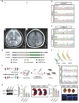 NUSAP1 regulates mitotic processes via KIF2C interaction and AURKA phosphorylation in primary microcephaly