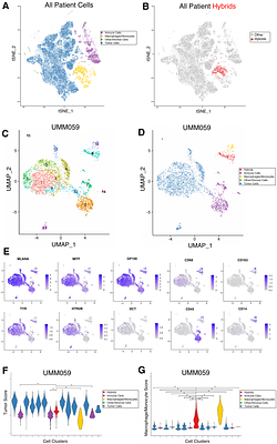 Analysis of uveal melanoma scRNA sequencing data identifies neoplastic-immune hybrid cells that exhibit metastatic potential
