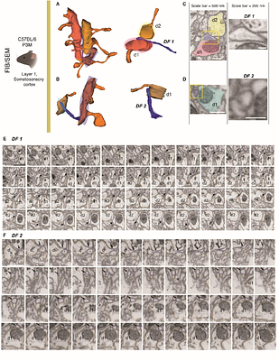 Intercellular communication in the brain via dendritic nanotubular network