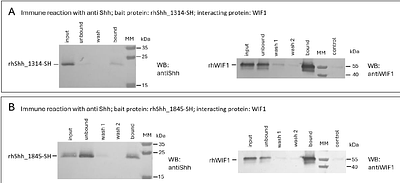 Lipid moieties of sonic hedgehog are important for interaction with its inhibitor, WIF1