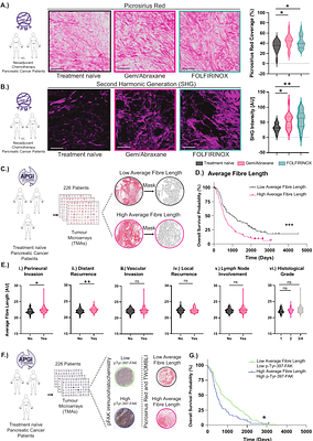 Pulsed priming with the FAK inhibitor narmafotinib enhances both gemcitabine/Abraxane and FOLFIRINOX chemotherapy response in pancreatic cancer