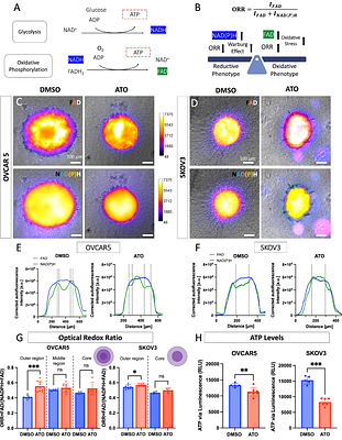 Modeling the metabolic heterogeneity of high-grade serous ovarian cancer solid tumors in 3D Microphysiological systems