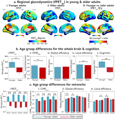 Brain glucodynamic variability is an essential feature of the metabolism-cognition relationship