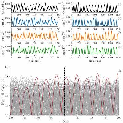 Neural-vocal phase coupling reveals structured timing in birdsong production