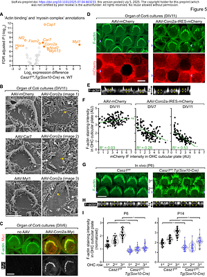 CASZ1 regulates the rate at which outer hair cells mature and is required for hearing