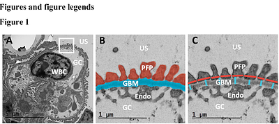 Digital pathology assessment of kidney glomerular filtration barrier ultrastructure in an animal model of podocytopathy