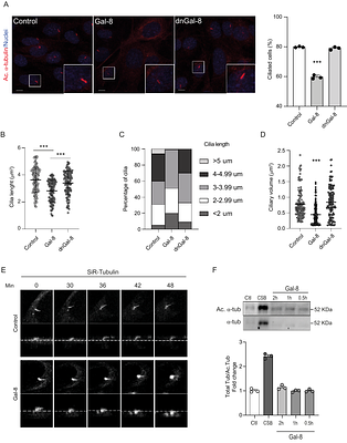Galectin-8 regulates primary cilium in hypothalamic neurons through anL-type calcium channel/Aurora kinaseA/HDAC6 pathway impacting body energy balance