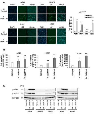 SRSF3 knockdown-induced cellular senescence as a possible therapeutic strategy for non-small cell lung cancer