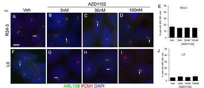 Aurora Kinase A Inhibition plus Tumor Treating Fields Suppress Glioma Cell Proliferation in a Cilium-Independent Manner