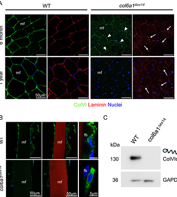 Col6 deficiency in a zebrafish model of Bethlem myopathy leads to dysfunction of the muscle dihydropyridine receptor