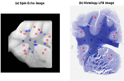 Impact of Tissue Sample Preparation Methods on Myelin-Sensitive Quantitative MR Imaging