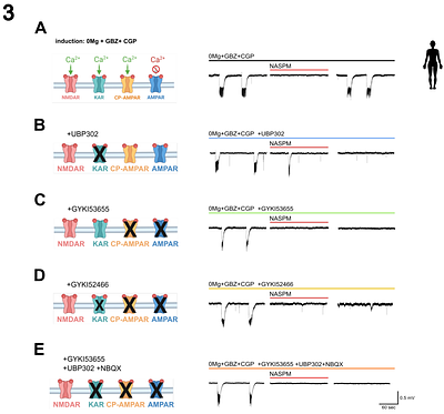 The polyamine naphthyl-acetyl spermine trihydrochloride (NASPM) lacks specificity for Ca2+-permeable AMPA receptors and suppresses seizure like activity in human brain tissue by inhibition of NMDA receptors.