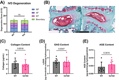 Intervertebral disc impairments in a mouse model of Alzheimer's Disease