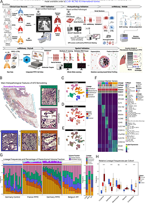 The pleuroparenchymal fibroelastosis atlas reveals aberrant cell states and their zonation as an alternate roadmap to lung fibrosis