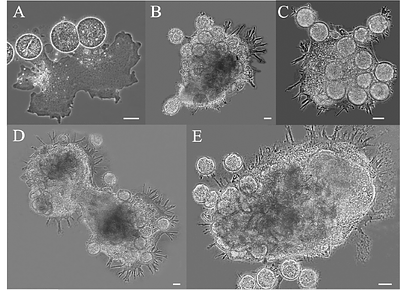 Fusion-associated sexual development in a testate amoeba fills a major gap in the evolution of sex in Amoebozoa