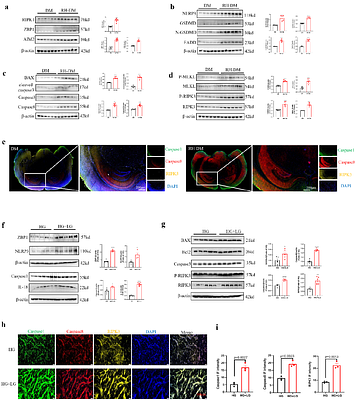 Hypoglycemia Aggravated Cognitive Degeneration by activating Endothelial ZBP1-mediated PANoptosis in Type 2 Diabetes
