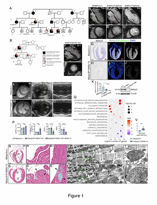 Abnormal ventricular wall patterning precedes and drives MYBPC3 hypertrophic cardiomyopathy